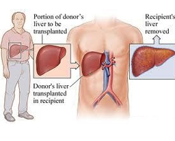 liver 123